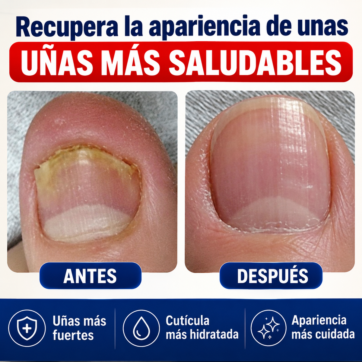 NailCare™ – Parches para Uñas Sanas | 2x1 por tiempo limitado